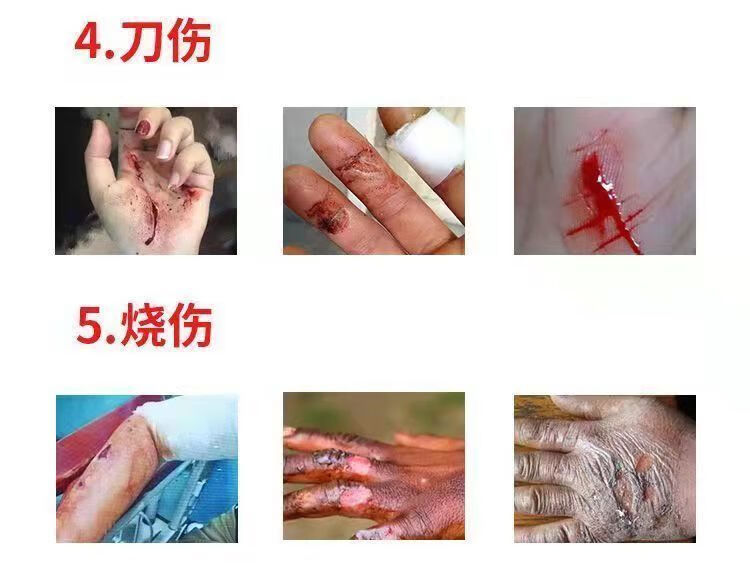 Chinese Herbal Cream for external use only. Brand Huatuo. Jinchuang Gao or Jinchuang Ointment or Jinchuang Cream for for all types of bedsores and ulcerated wounds to relieve the injured surface.