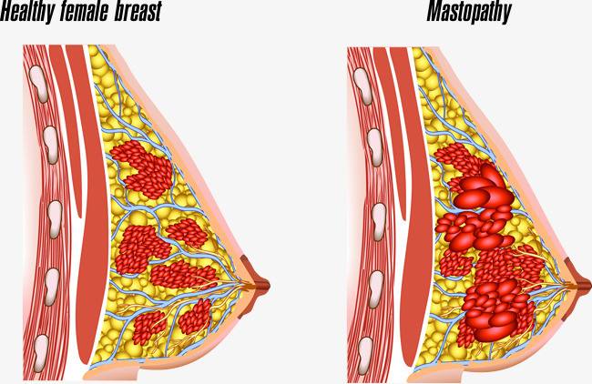 Chinese Herbs. Brand Hao Hu Shi. Rupixiao Pian or Ru Pi Xiao Pian or RupixiaoPian or Rupixiao Tablets or Ru Pi Xiao Tablets Softening hardness to dissipate stagnation, for cute mastitis, breastcarbuncle,breast nodules and breast tumours. hyperplasia.